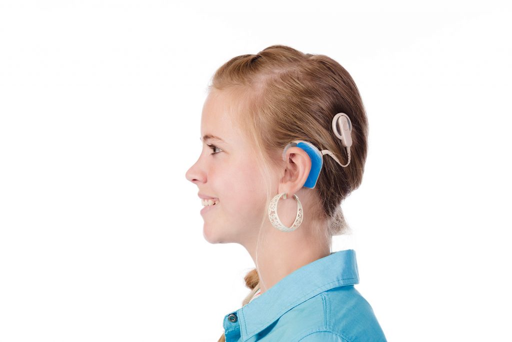 Cochlearimplant 1 1024x683 
